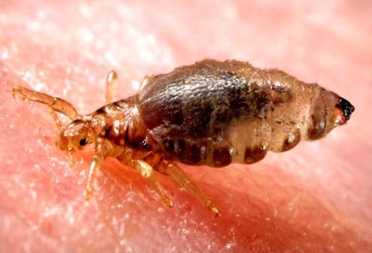 Bedbugs, Lice, Mites